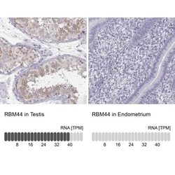 RBM44 Antibody, Novus Biologicals 25 &mu;L, Unlabeled:Antibodies, Polyclonal